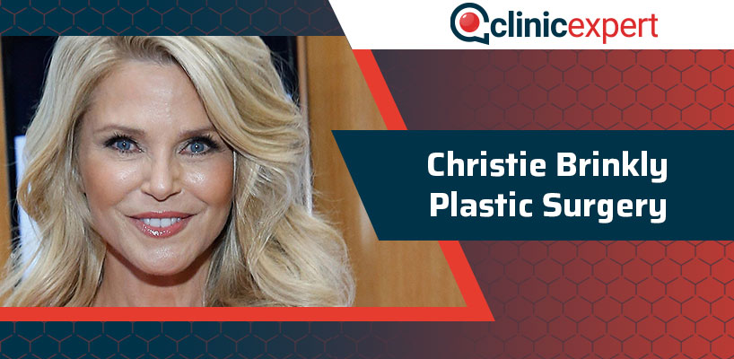 Christie Brinkly Plastic Surgery