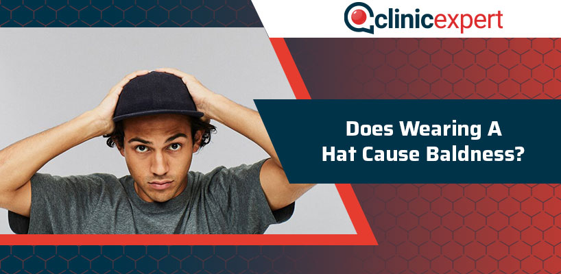 Does Wearing A Hat Cause Baldness?