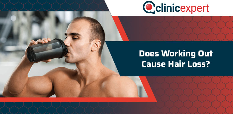 Does Working Out Cause Hair Loss?