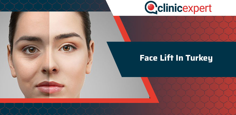 Face Lift operation In Turkey