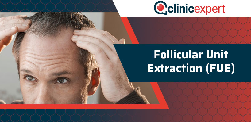 Follicular Unit Extraction (FUE)