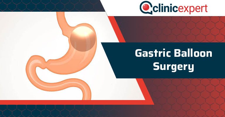 Gastric Balloon Surgery