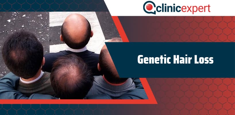 Curing Genetic Hair Loss