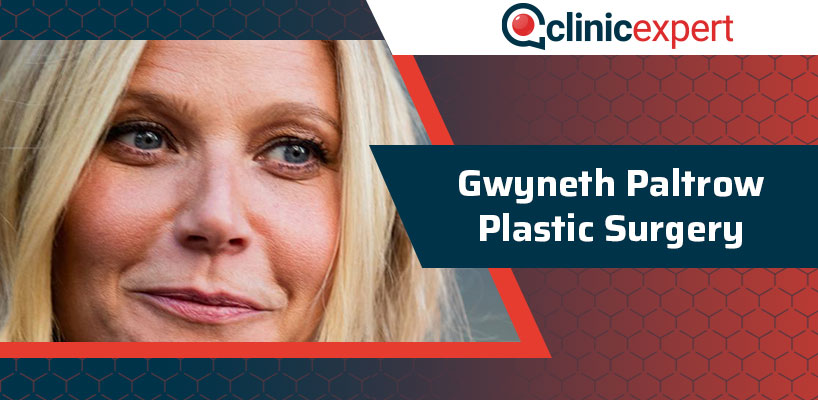 Gwyneth Paltrow Plastic Surgery