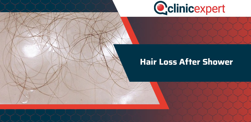 Hair Loss After Shower Is It Normal? | ClinicExpert