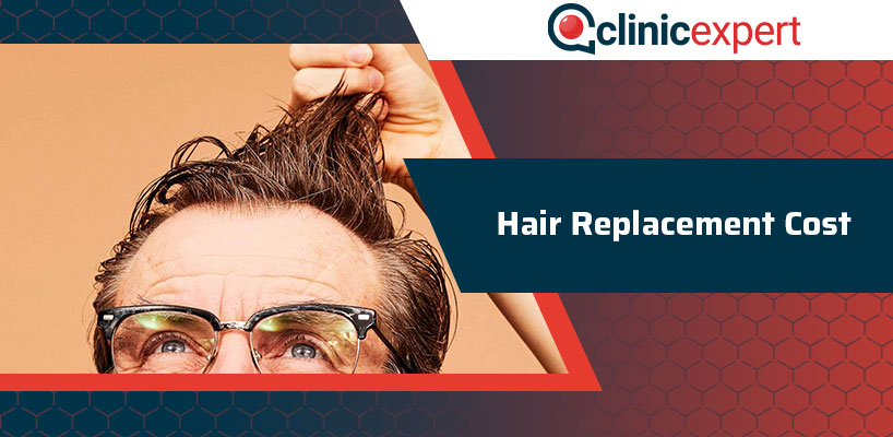 Hair Replacement Cost
