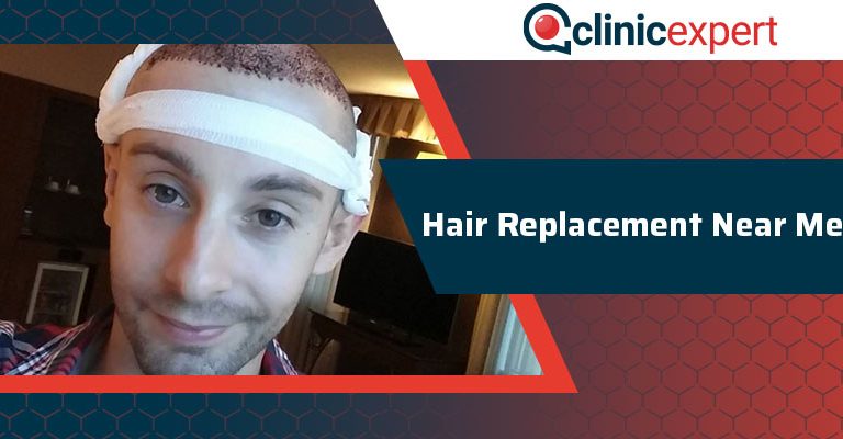 Hair Replacement Near Me