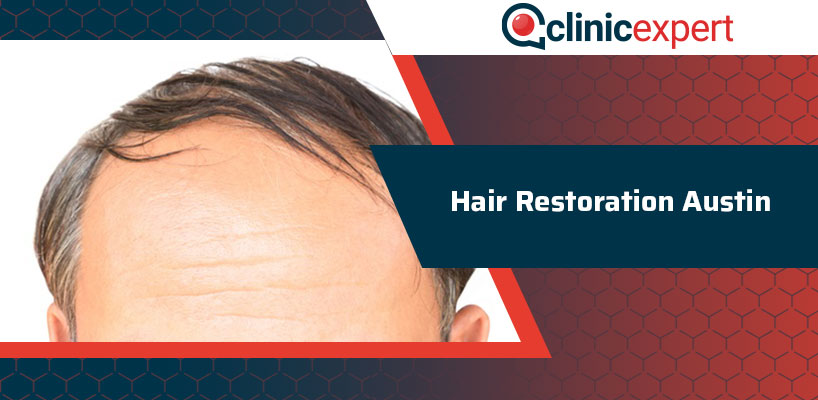 Hair Restoration Austin