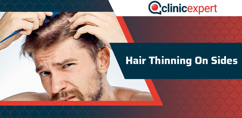 Hair Thinning On Sides