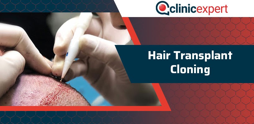 Hair Transplant Cloning