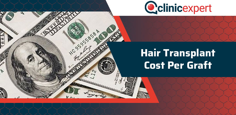 Hair Transplant Cost Per Graft