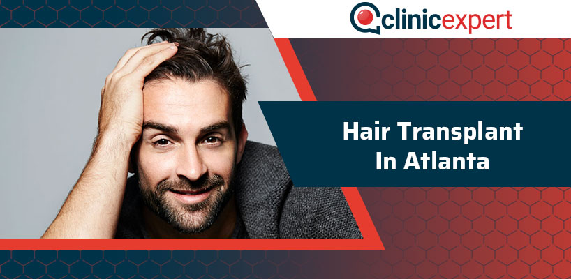 Hair Transplant In Atlanta