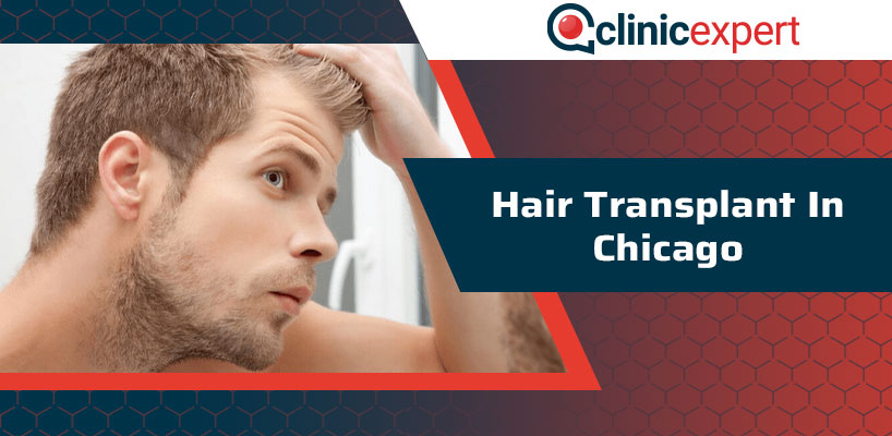 Hair Transplant In Chicago