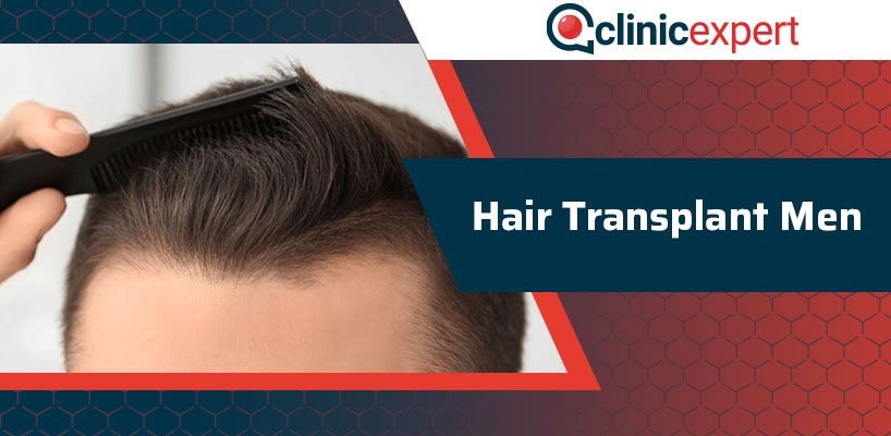 Hair Transplant Men