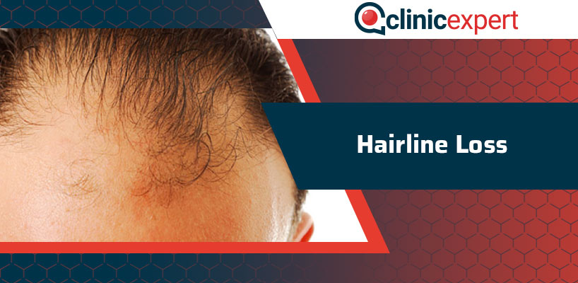 Hairline Loss
