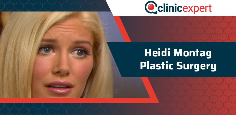 Heidi Montag Plastic Surgery