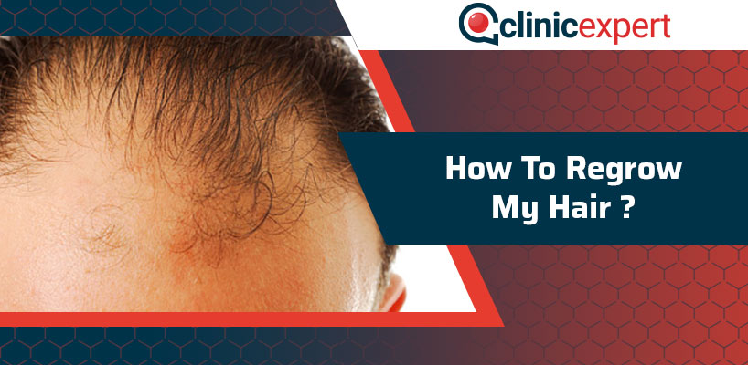 How To Regrow My Hair? | ClinicExpert