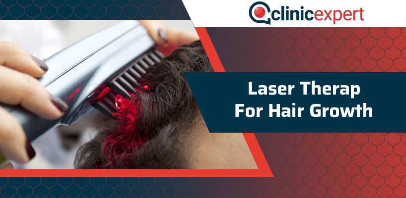 Laser Therapy for Hair Growth