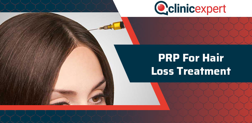 PRP For Hair Loss Treatment