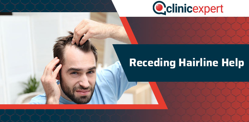 Receding Hairline Help