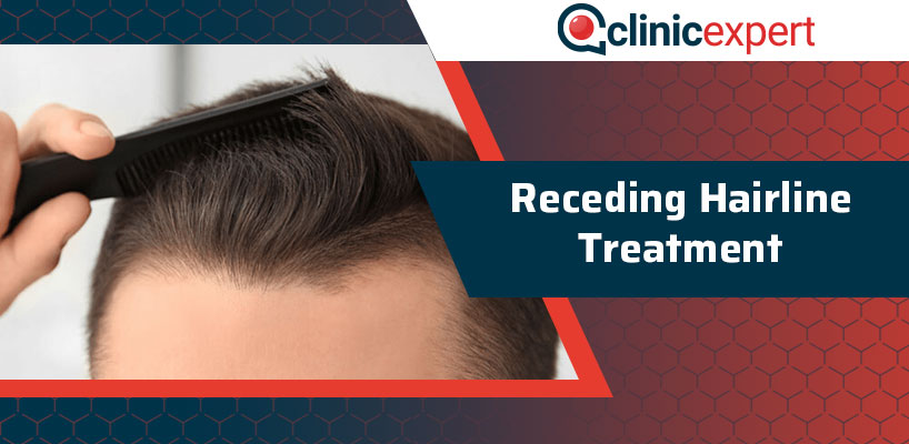 Receding Hairline Treatment