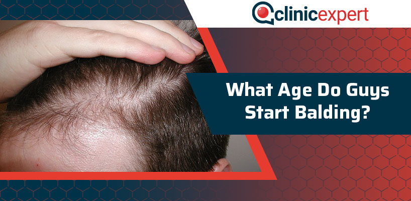 What Age Do Guys Start Balding? | ClinicExpert International Healthcare
