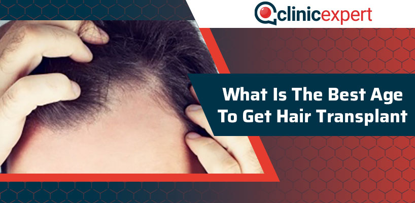 What Is The Best Age To Get A Hair Transplant?