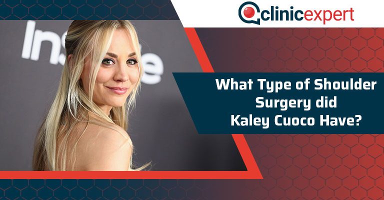 What Type Of Shoulder Surgery did Kaley Cuoco Have?