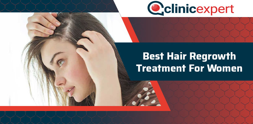 Best Hair Regrowth Treatment For Women