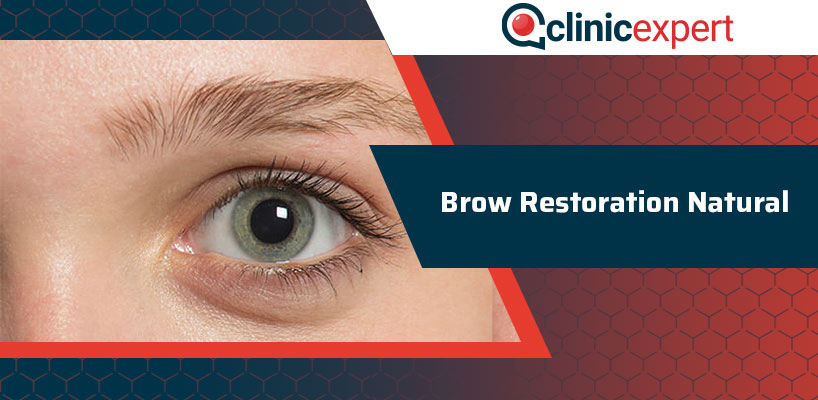 Brow Restoration Natural