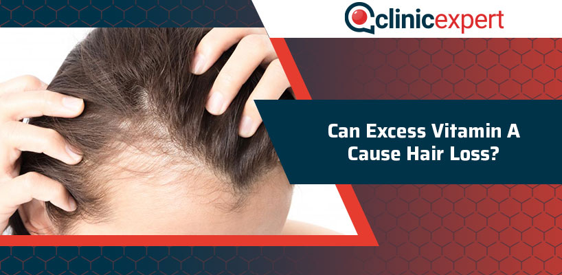 Can Excess Vitamin A Cause Hair Loss?