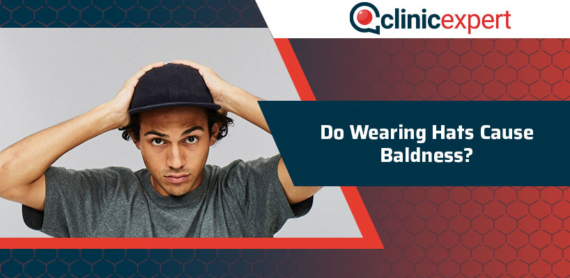 Do Wearing Hats Cause Baldness?