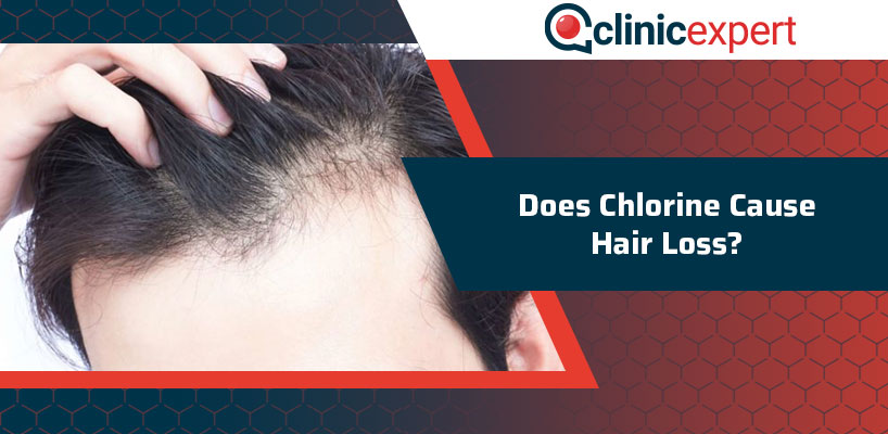 Does Chlorine Cause Hair Loss?