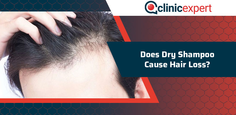 Does Dry Shampoo Cause Hair Loss?