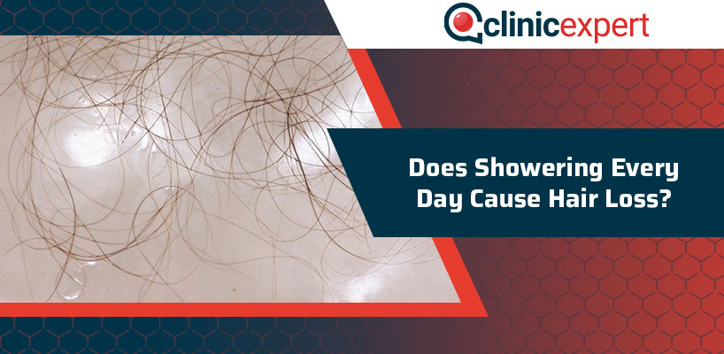 Does Showering Every Day Cause Hair Loss?