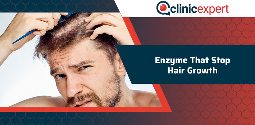 Enzyme That Stop Hair Growth