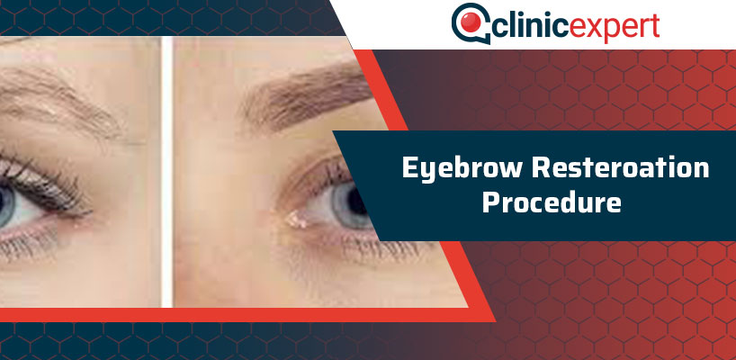 Eyebrow Restoration Procedure