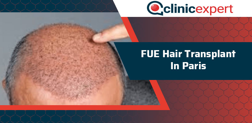 FUE Hair Transplant In Paris | ClinicExpert FUE Hair Transplant In Paris | ClinicExpert