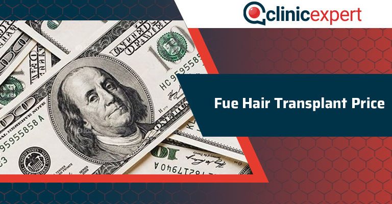 Fue Hair Transplant Price