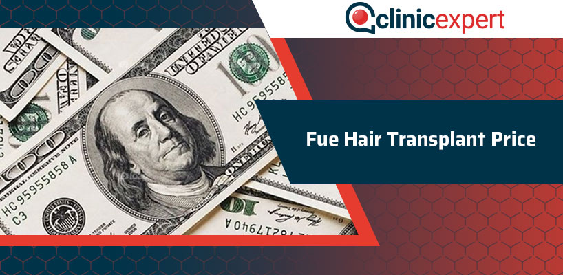 Fue Hair Transplant Price