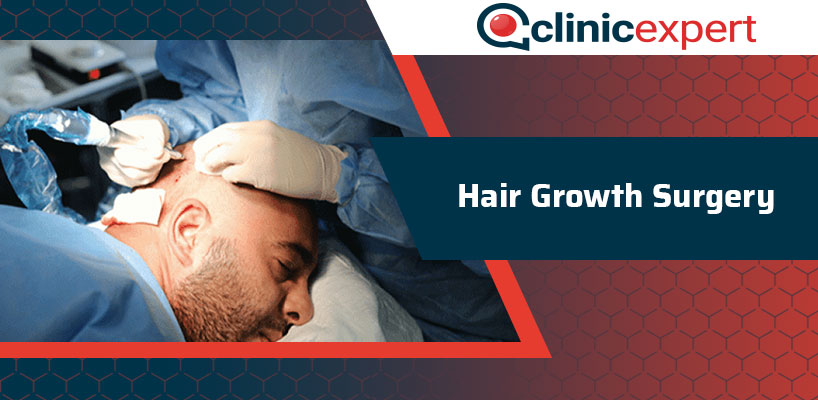 Hair Growth Surgery