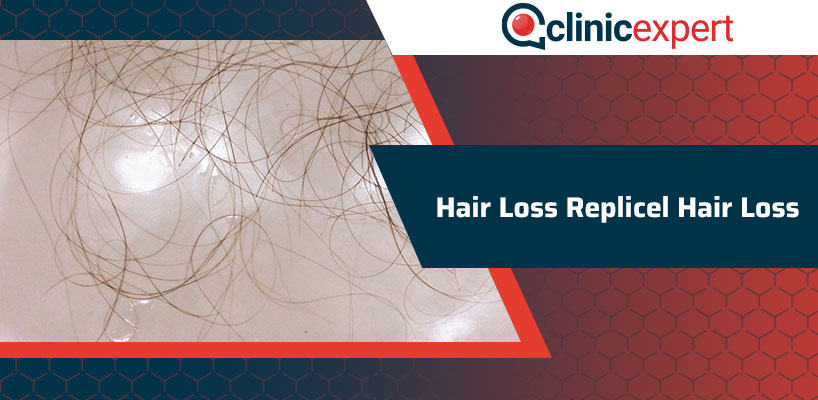 Hair Loss Replicel Hair Loss