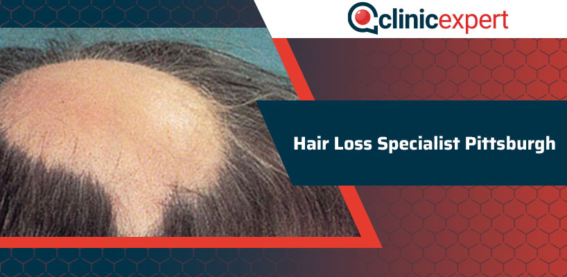 Hair Loss Specialist Pittsburgh