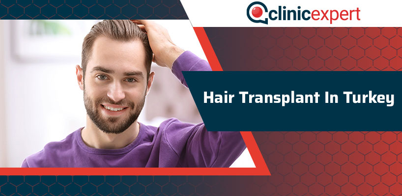 Hair Transplant In Turkey