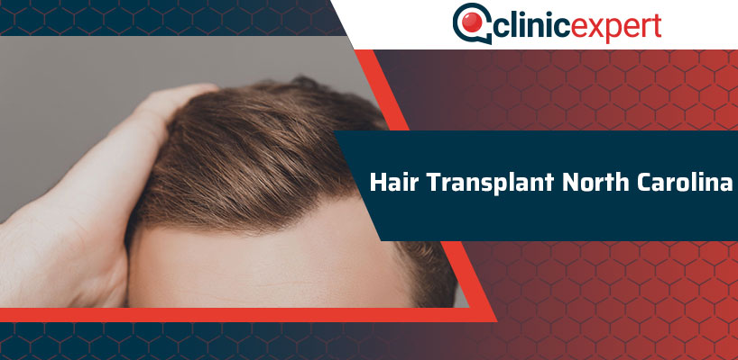 Hair Transplant North Carolina