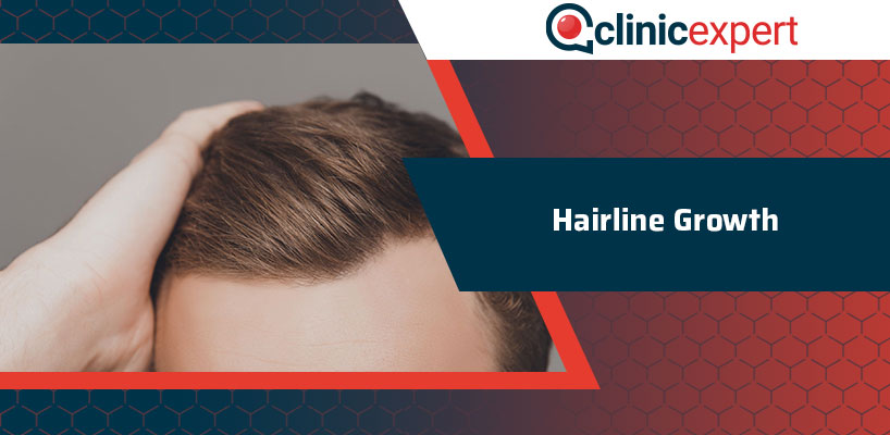 Hairline Growth