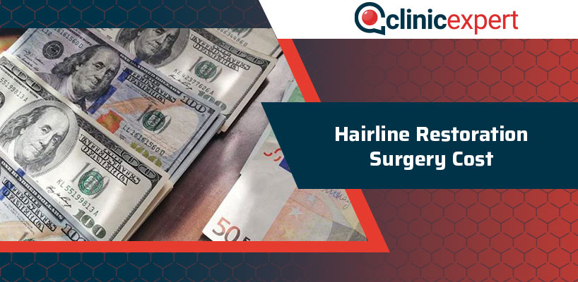 Hairline Restoration Surgery Cost