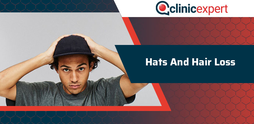 Hats And Hair Loss