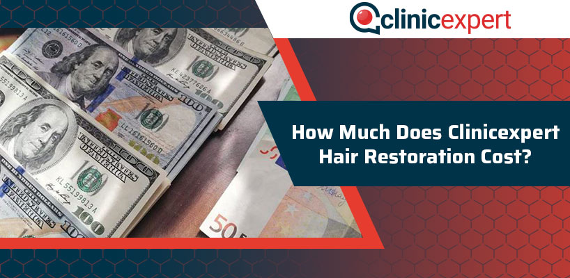 How Much does Clinicexpert Hair Restoration Cost?