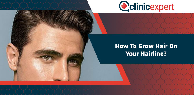How To Grow Hair On Your Hairline